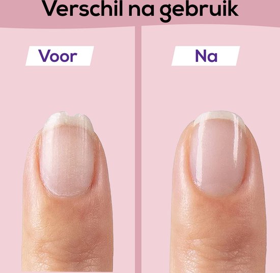 SafeCare Baby Nagelvijlset – Elektrisch, Veilig en Geruisloos Vijlen voor Baby’s